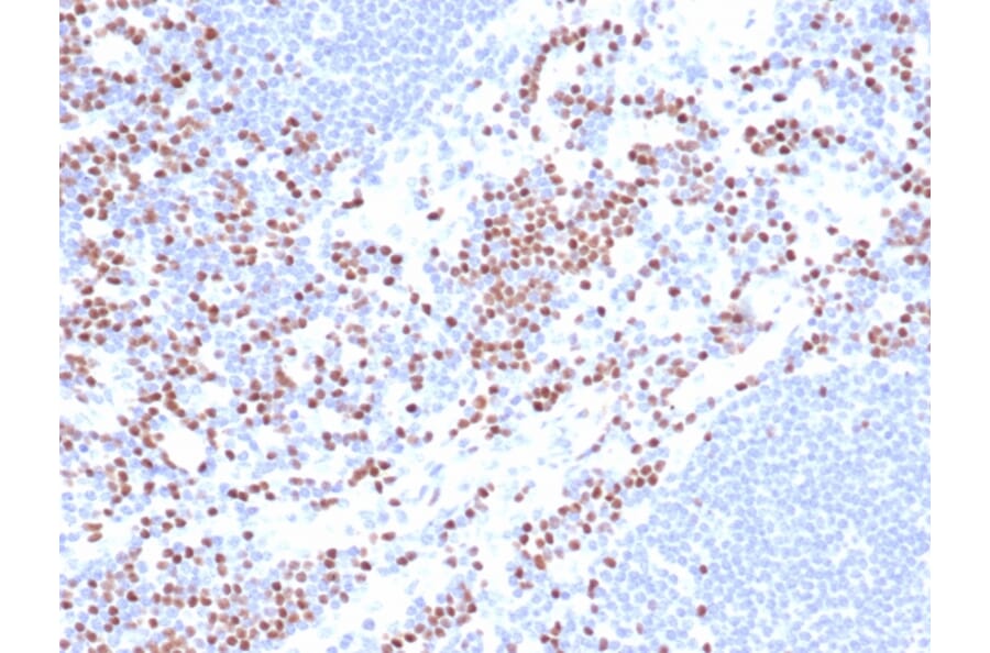 Immunohistochemistry - Anti-LEF1 Antibody [LEF1/422R] (A249582) - Antibodies.com