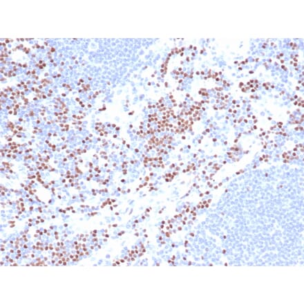 Immunohistochemistry - Anti-LEF1 Antibody [LEF1/422R] (A249582) - Antibodies.com