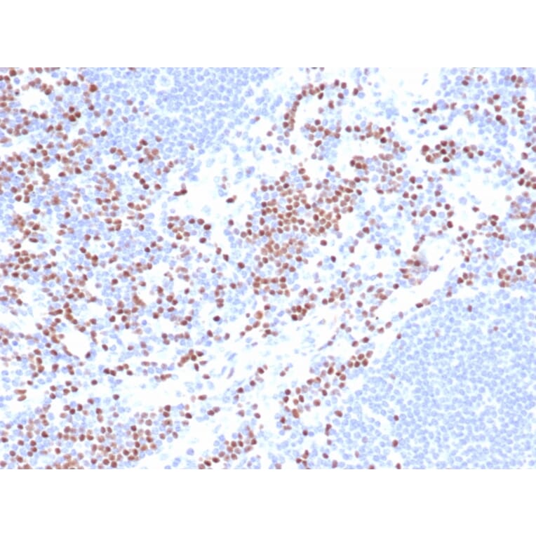 Immunohistochemistry - Anti-LEF1 Antibody [LEF1/422R] (A249582) - Antibodies.com