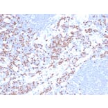 Immunohistochemistry - Anti-LEF1 Antibody [LEF1/422R] (A249582) - Antibodies.com
