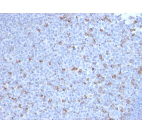 Immunohistochemistry - Anti-PD1 Antibody [PDCD1/2720] (A249584) - Antibodies.com