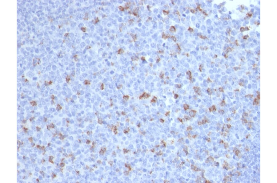 Immunohistochemistry - Anti-PD1 Antibody [PDCD1/2720] (A249584) - Antibodies.com