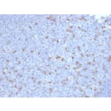 Immunohistochemistry - Anti-PD1 Antibody [PDCD1/2720] (A249584) - Antibodies.com