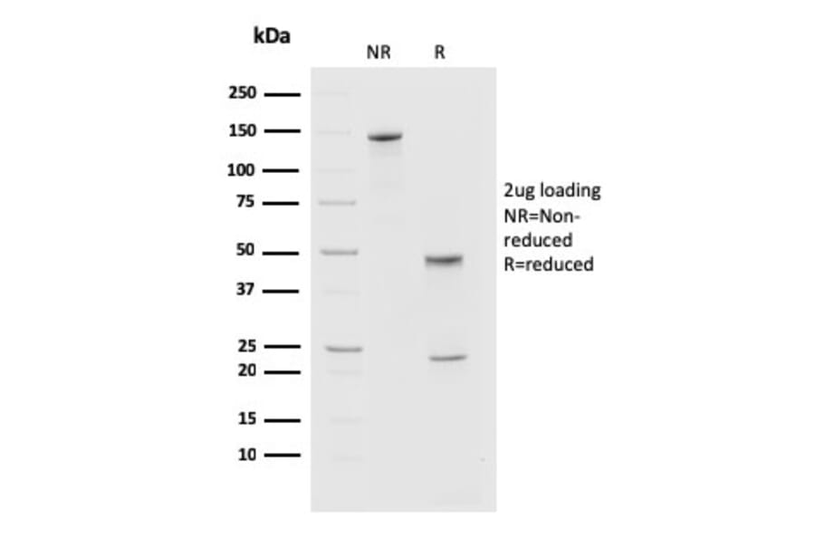 SDS-PAGE - Anti-PD1 Antibody [PDCD1/2720] (A249584) - Antibodies.com