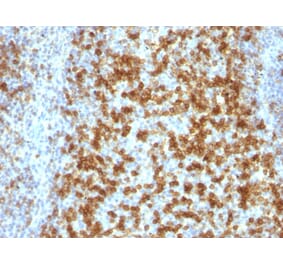Immunohistochemistry - Anti-PD1 Antibody [PDCD1/922] (A249585) - Antibodies.com