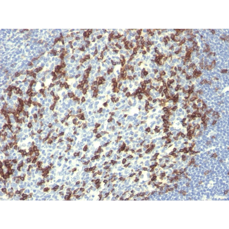 Immunohistochemistry - Anti-PD1 Antibody [PDCD1/922] (A249584) - Antibodies.com