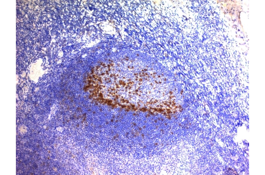 Immunohistochemistry - Anti-PD1 Antibody [SPM597] (A252765) - Antibodies.com