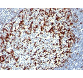 Immunohistochemistry - Anti-PD1 Antibody [NAT105] (A249586) - Antibodies.com