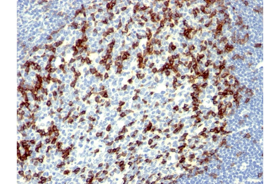 IHC - Anti-PD1 Antibody [NAT105] (A249587)