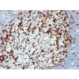Immunohistochemistry - Anti-PD1 Antibody [NAT105] (A249586) - Antibodies.com