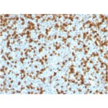 Immunohistochemistry - Anti-PD1 Antibody [PDCD1/1410R] (A249587) - Antibodies.com