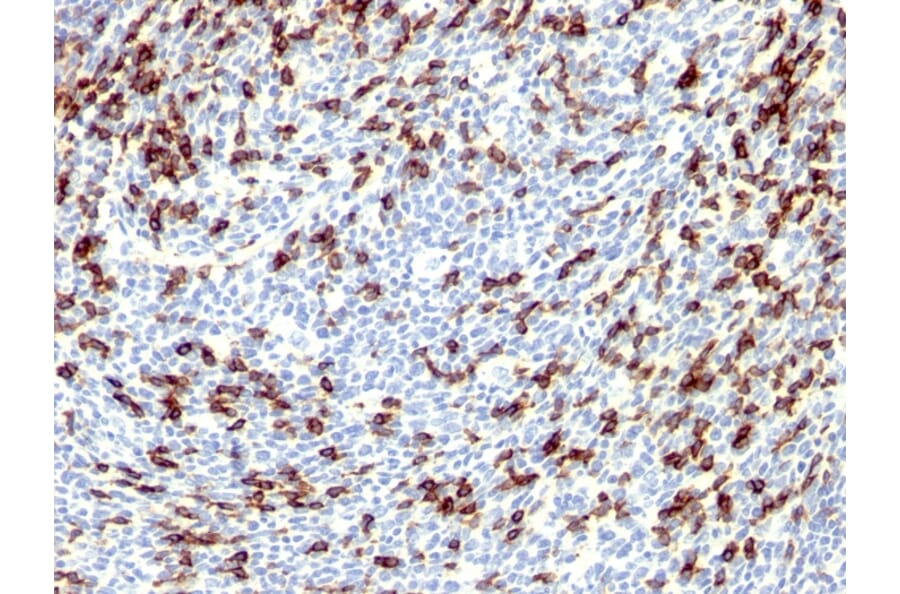 Immunohistochemistry - Anti-PD1 Antibody (A249588) - Antibodies.com