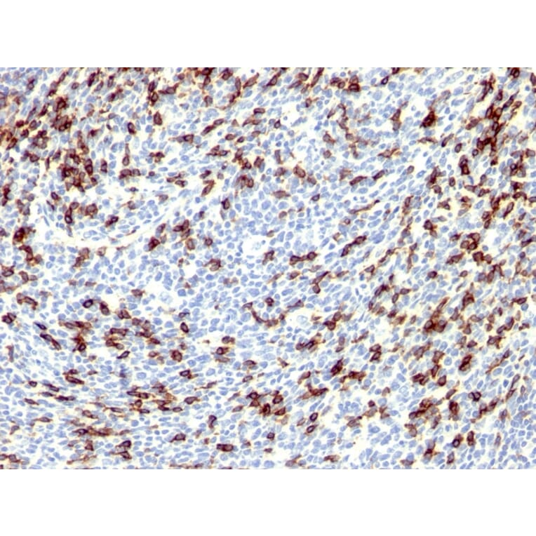 Immunohistochemistry - Anti-PD1 Antibody (A249588) - Antibodies.com