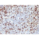 Immunohistochemistry - Anti-PD1 Antibody (A249588) - Antibodies.com