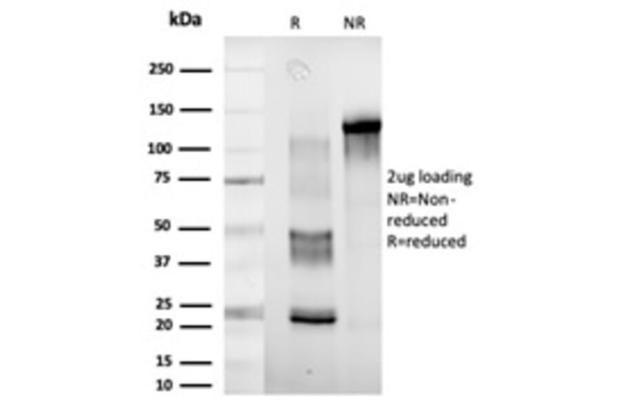 SDS-PAGE - Anti-DDX41 Antibody [PCRP-DDX41-1B4] (A249590) - Antibodies.com
