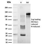 SDS-PAGE - Anti-DDX41 Antibody [PCRP-DDX41-1B4] (A249590) - Antibodies.com