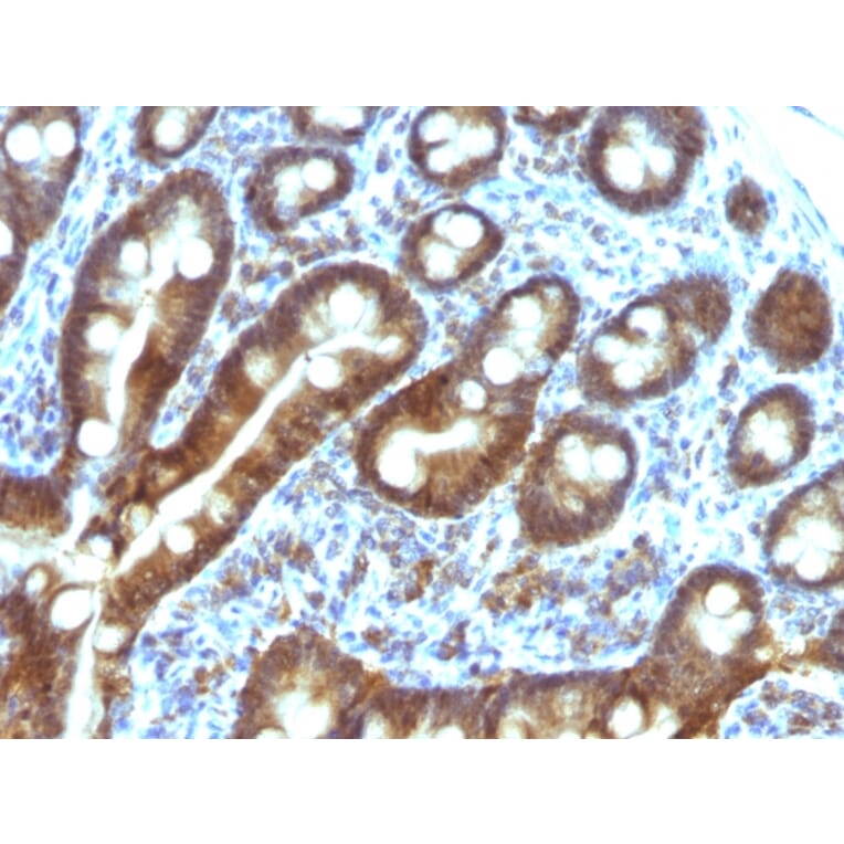 Immunohistochemistry - Anti-TDP2 Antibody [TDP2/1258] (A249591) - Antibodies.com