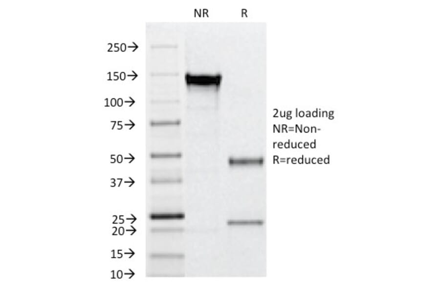 SDS-PAGE - Anti-CD31 Antibody [C31.12] (A249591) - Antibodies.com
