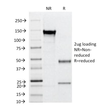 SDS-PAGE - Anti-CD31 Antibody [C31.12] (A249591) - Antibodies.com