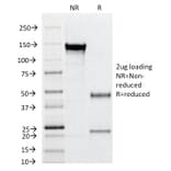 SDS-PAGE - Anti-CD31 Antibody [C31.12] (A249591) - Antibodies.com