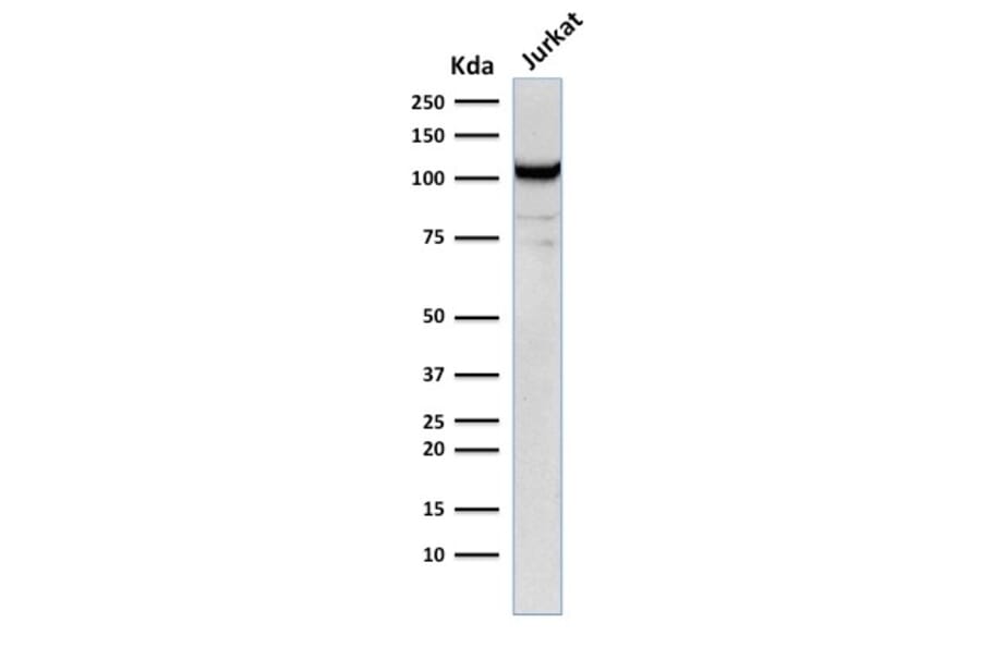 Western Blot - Anti-CD31 Antibody [C31.12] (A249592) - Antibodies.com