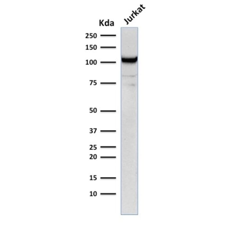Western Blot - Anti-CD31 Antibody [C31.12] (A249592) - Antibodies.com