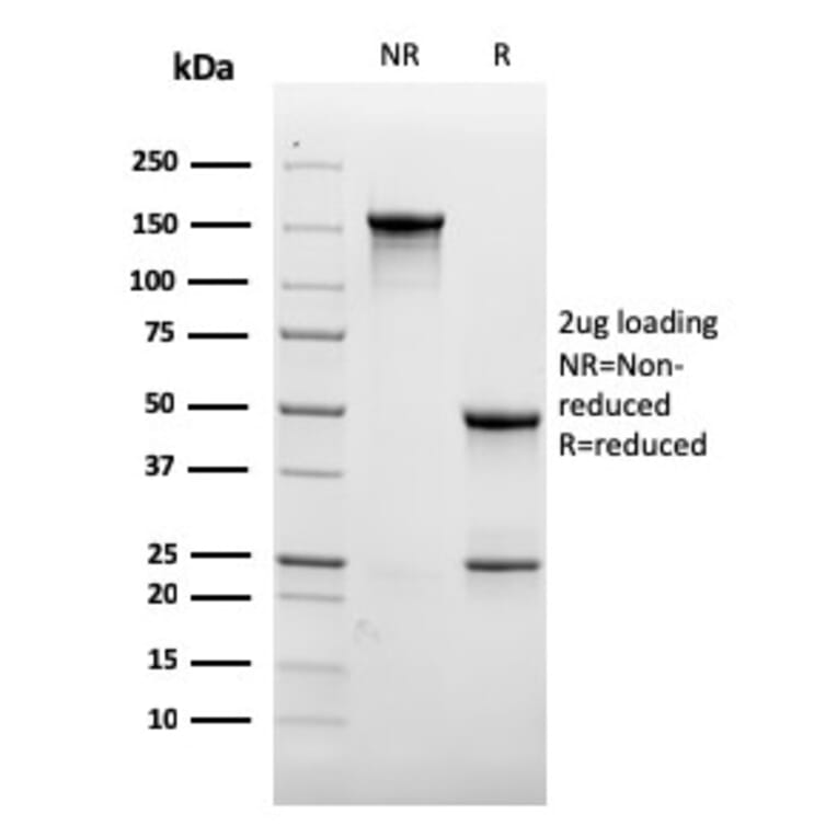 SDS-PAGE - Anti-CD31 Antibody [rC31.3] (A249592) - Antibodies.com