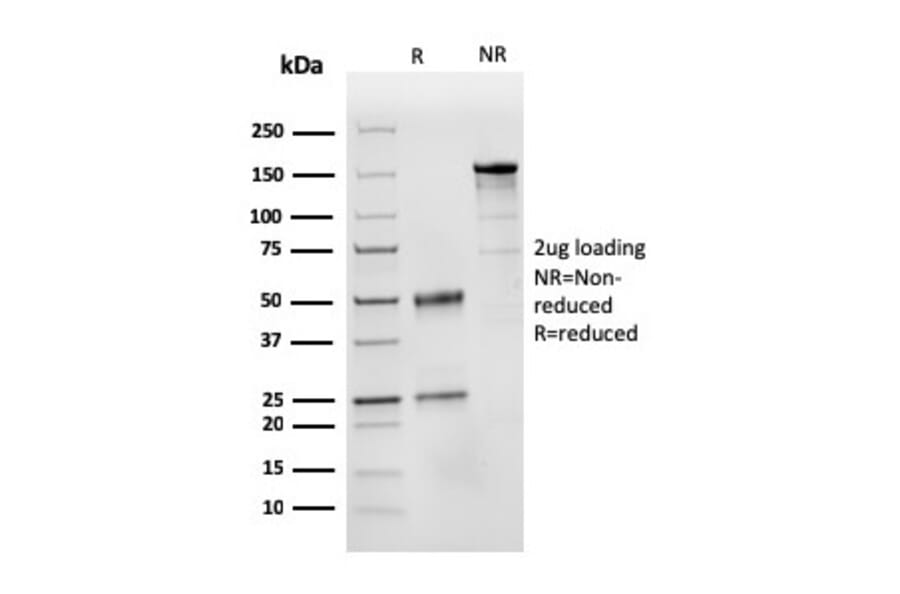 SDS-PAGE - Anti-CD31 Antibody [PECAM1/3525] (A249594) - Antibodies.com