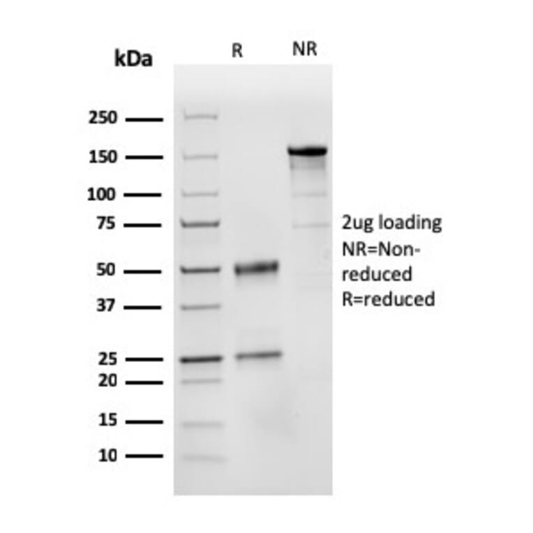 SDS-PAGE - Anti-CD31 Antibody [PECAM1/3525] (A249594) - Antibodies.com