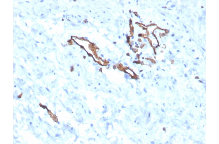 Immunohistochemistry - Anti-CD31 Antibody [PECAM1/3525] (A249594) - Antibodies.com