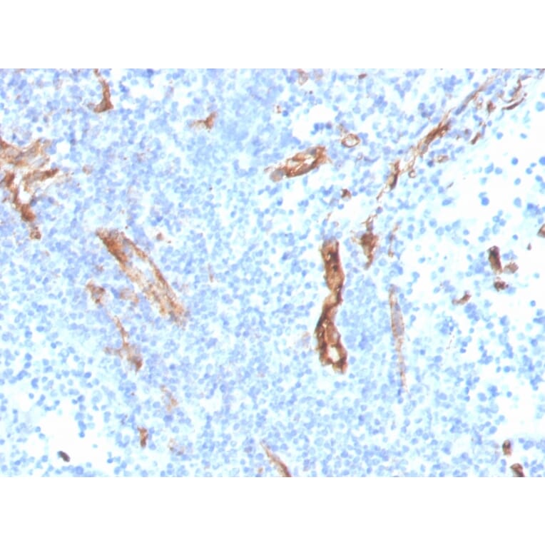 Immunohistochemistry - Anti-CD31 Antibody [PECAM1/3527] (A249596) - Antibodies.com