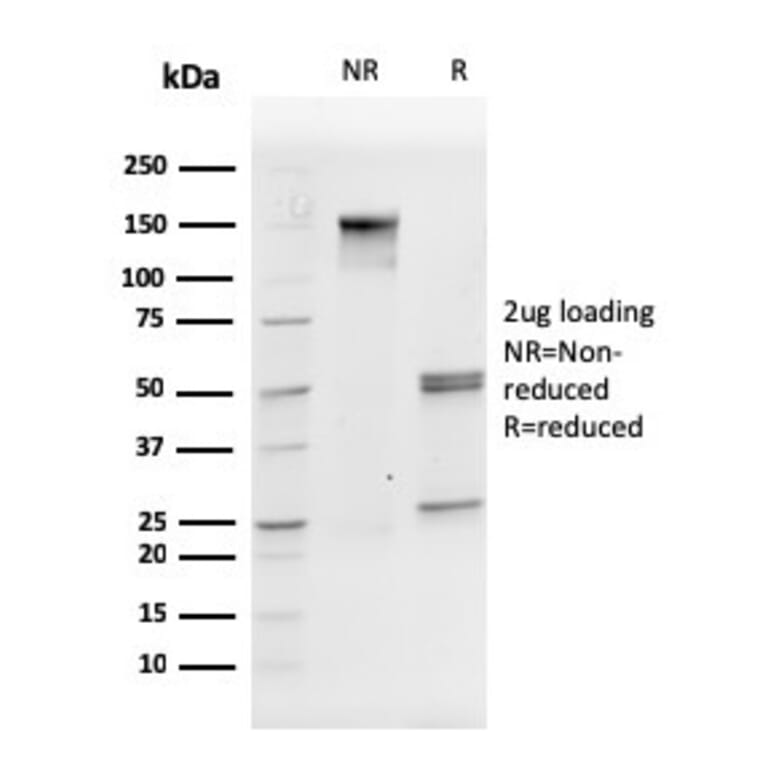 SDS-PAGE - Anti-CD31 Antibody [PECAM1/3527] (A249596) - Antibodies.com