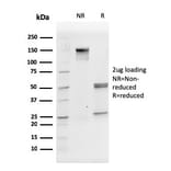 SDS-PAGE - Anti-CD31 Antibody [PECAM1/3527] (A249596) - Antibodies.com