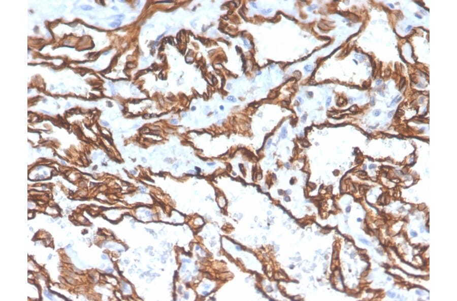 Immunohistochemistry - Anti-CD31 Antibody [PECAM1/3529] (A249598) - Antibodies.com