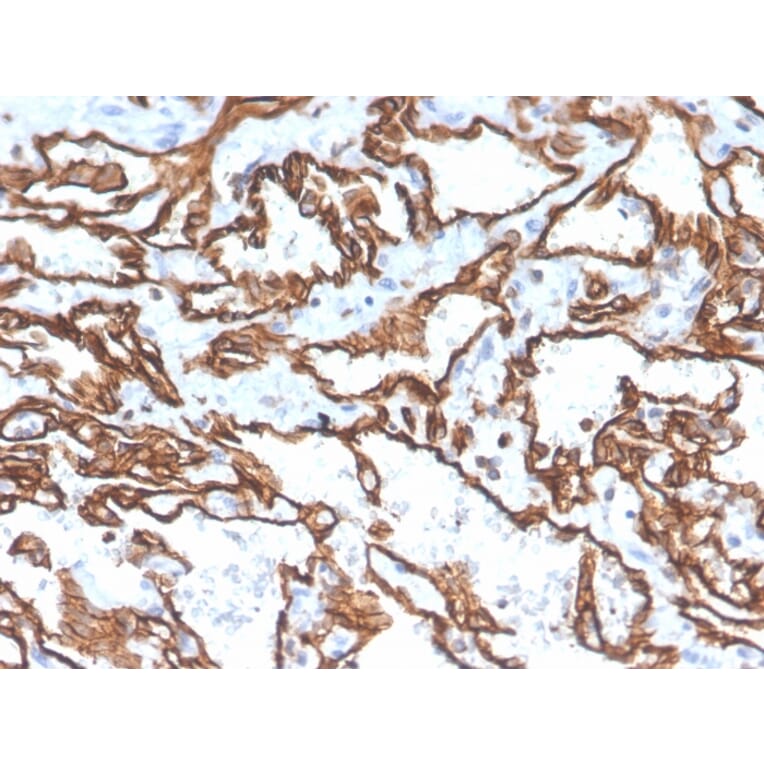 Immunohistochemistry - Anti-CD31 Antibody [PECAM1/3529] (A249598) - Antibodies.com