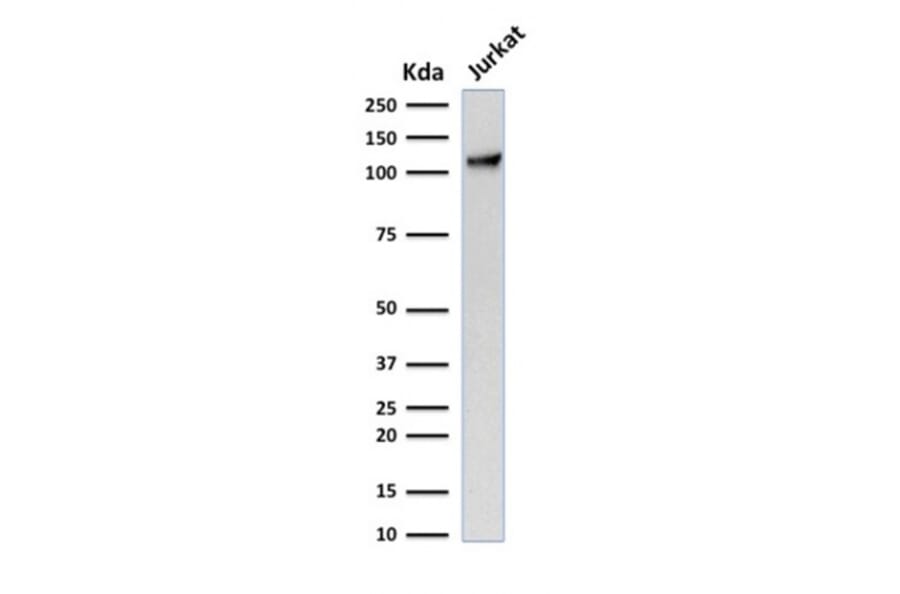 Western Blot - Anti-CD31 Antibody [C31.7] (A249599) - Antibodies.com