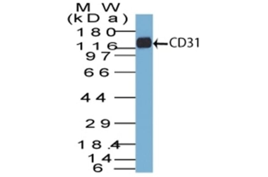 Western Blot - Anti-CD31 Antibody [C31.7] (A249599) - Antibodies.com