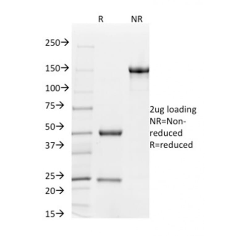 SDS-PAGE - Anti-CD31 Antibody [C31.7] (A249599) - Antibodies.com