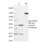 SDS-PAGE - Anti-CD31 Antibody [C31.7] (A249599) - Antibodies.com