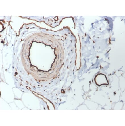 Immunohistochemistry - Anti-CD31 Antibody [PECAM1/3530] (A249600) - Antibodies.com