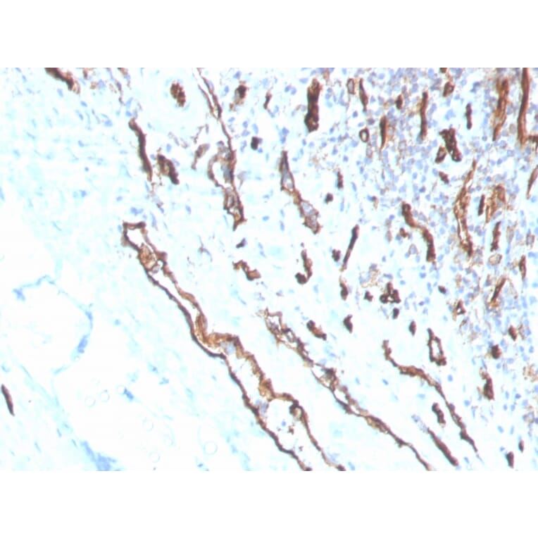Immunohistochemistry - Anti-CD31 Antibody [PECAM1/3530] (A249600) - Antibodies.com