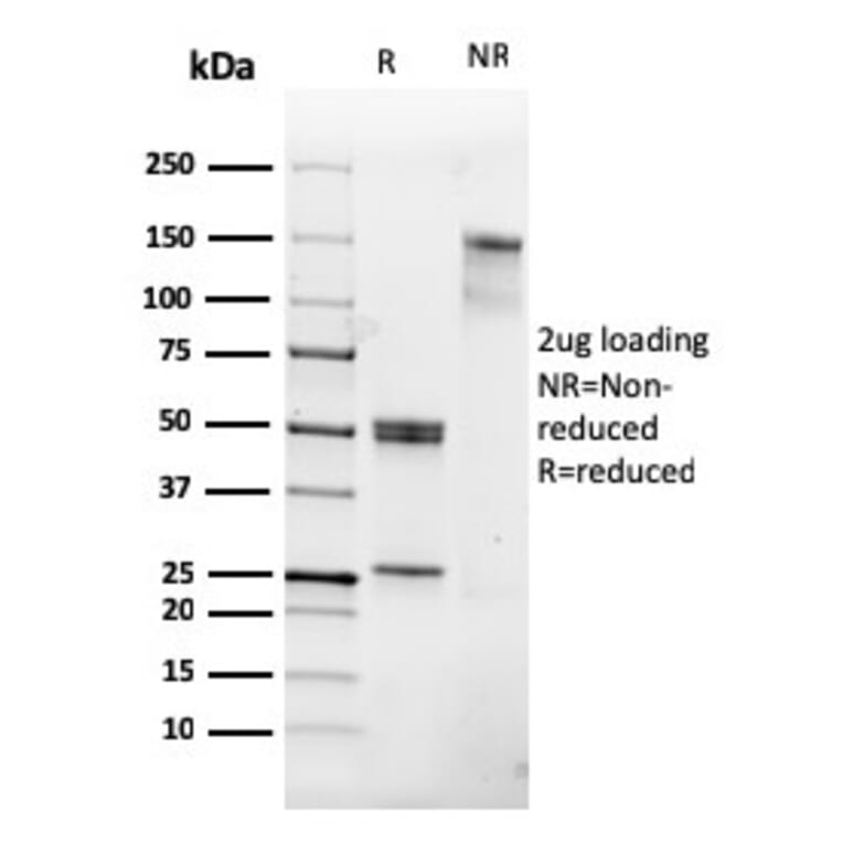 SDS-PAGE - Anti-CD31 Antibody [PECAM1/3530] (A249600) - Antibodies.com