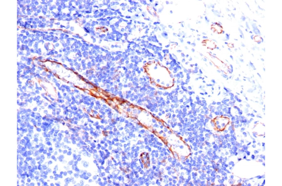 Immunohistochemistry - Anti-CD31 Antibody [C31.3] (A249601) - Antibodies.com