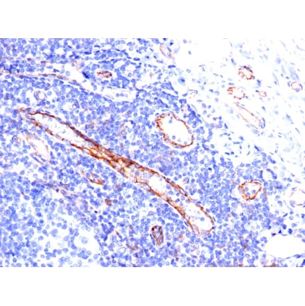 Immunohistochemistry - Anti-CD31 Antibody [C31.3] (A249601) - Antibodies.com