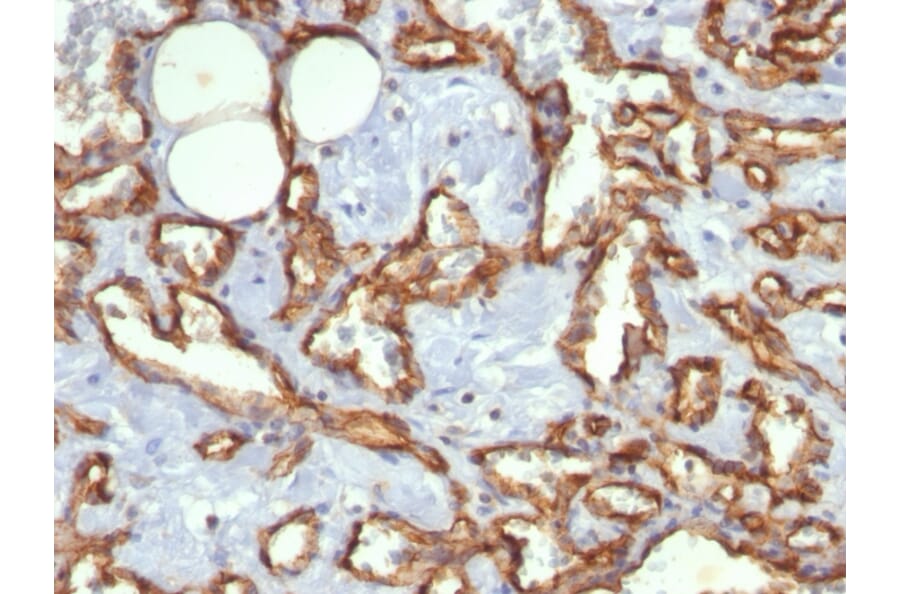 Immunohistochemistry - Anti-CD31 Antibody [C31.3] (A249601) - Antibodies.com