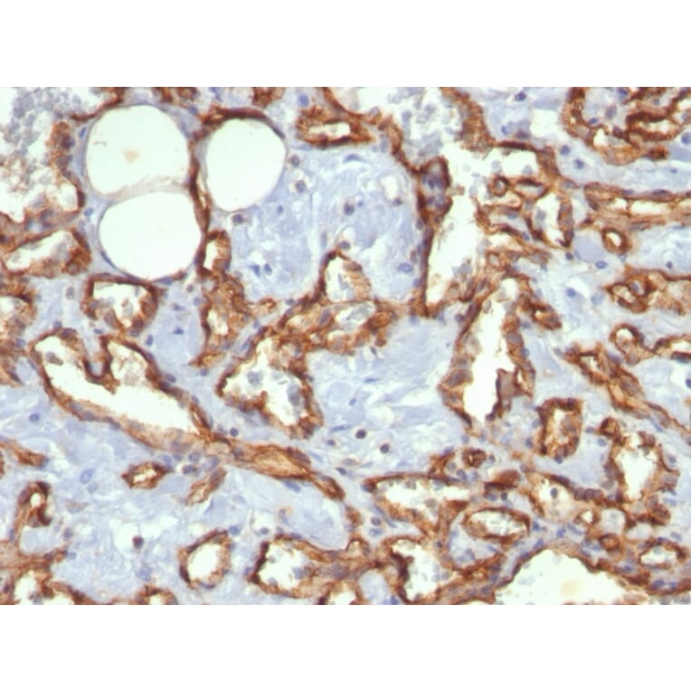 Immunohistochemistry - Anti-CD31 Antibody [C31.3] (A249601) - Antibodies.com