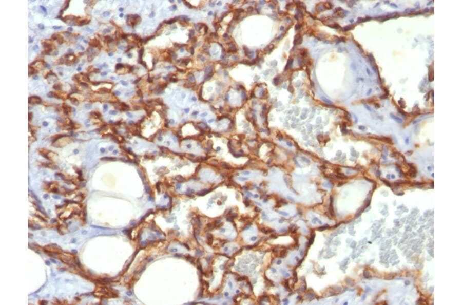Immunohistochemistry - Anti-CD31 Antibody [SPM532] (A249602) - Antibodies.com
