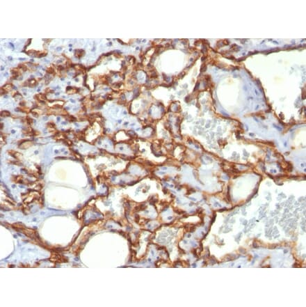 Immunohistochemistry - Anti-CD31 Antibody [SPM532] (A249602) - Antibodies.com