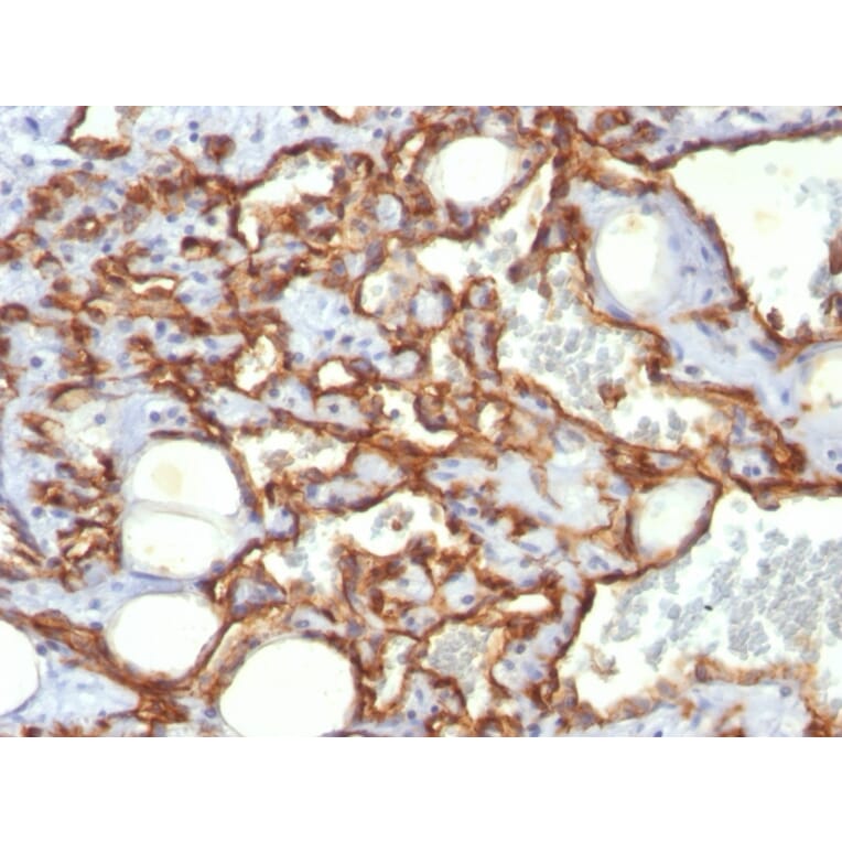 Immunohistochemistry - Anti-CD31 Antibody [SPM532] (A249602) - Antibodies.com