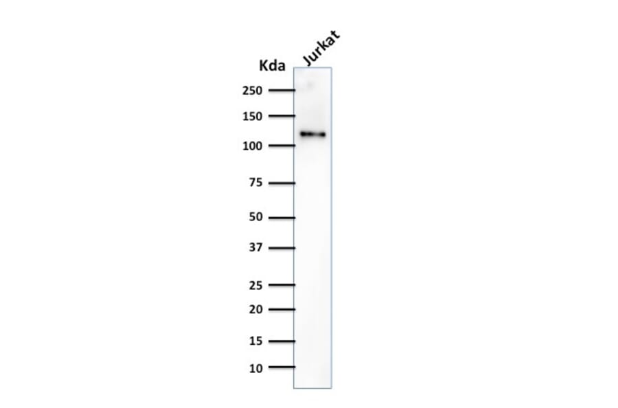Western Blot - Anti-CD31 Antibody [SPM532] (A249602) - Antibodies.com